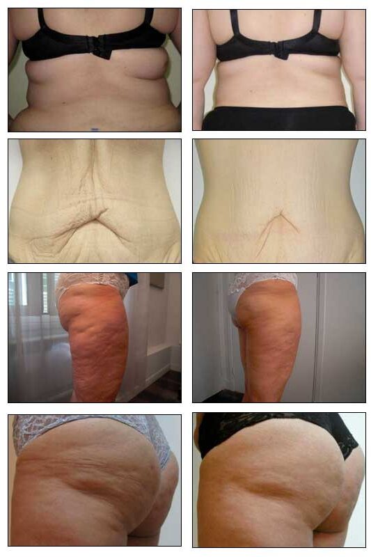 Angel Soins du Corps - Centre Esthétique et Anti-âge