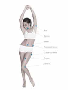 cryolipolyse_angel soins du corps